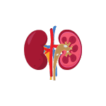 Cálculo renal o que é e como tratar?